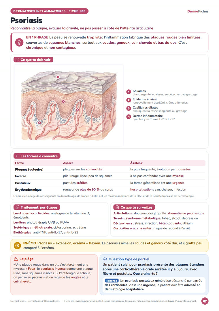Fiche « Psoriasis » de DermaFiches